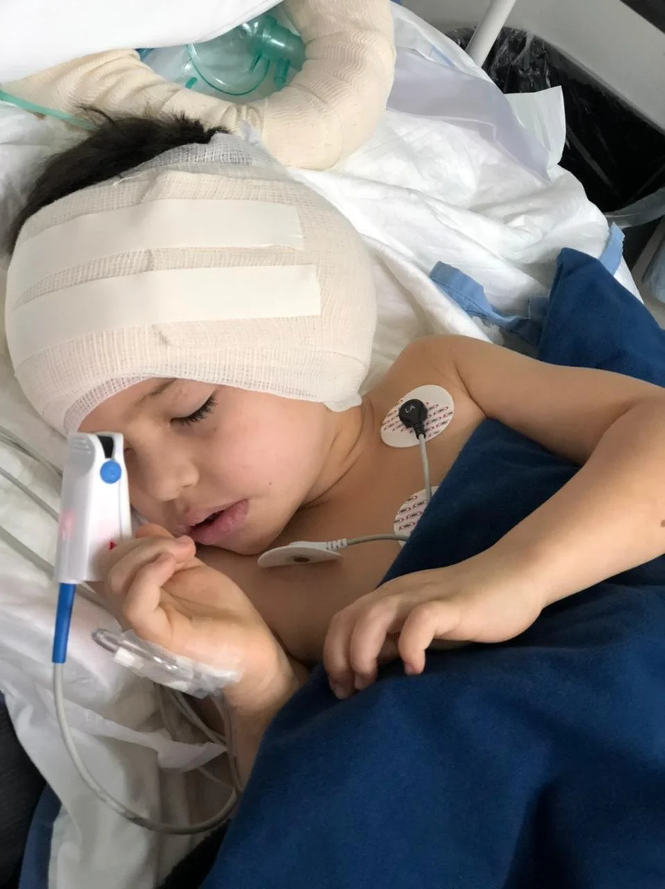 A young child with a head injury covered by a bandage is lying in a hospital bed, connected to medical monitoring devices, with eyes closed and appearing to be asleep or unconscious.