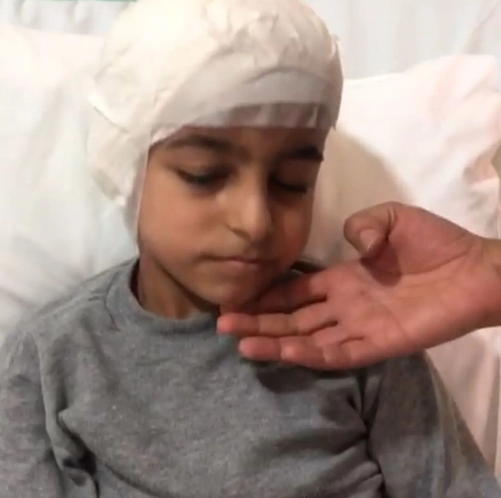 A young boy with a medical cap resting on a hospital bed, gently holding a person's hand.