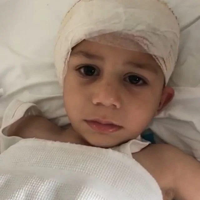 Young boy with a Band-Aid on his forehead, lying in a hospital bed with a hospital gown, looking at the camera.
