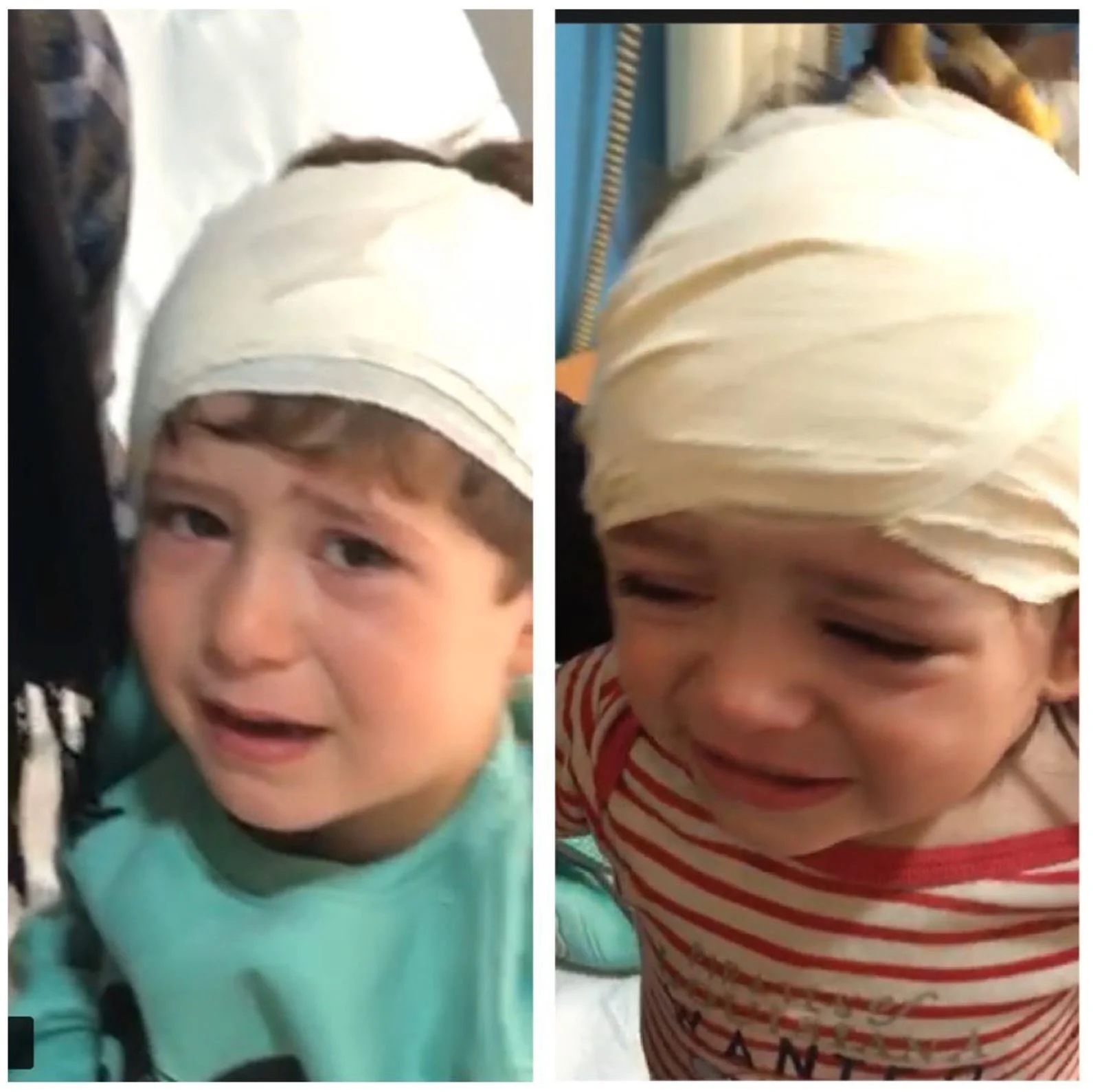 Side-by-side photos of a young boy with a bandage wrapped around his head, appearing to be crying or upset, wearing a striped red and white shirt in the right image and a light blue shirt in the left image.