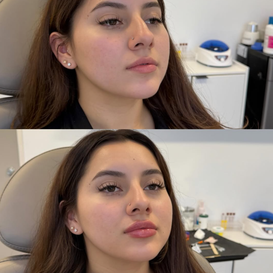 Medspa in Newport Beach, CA 92660