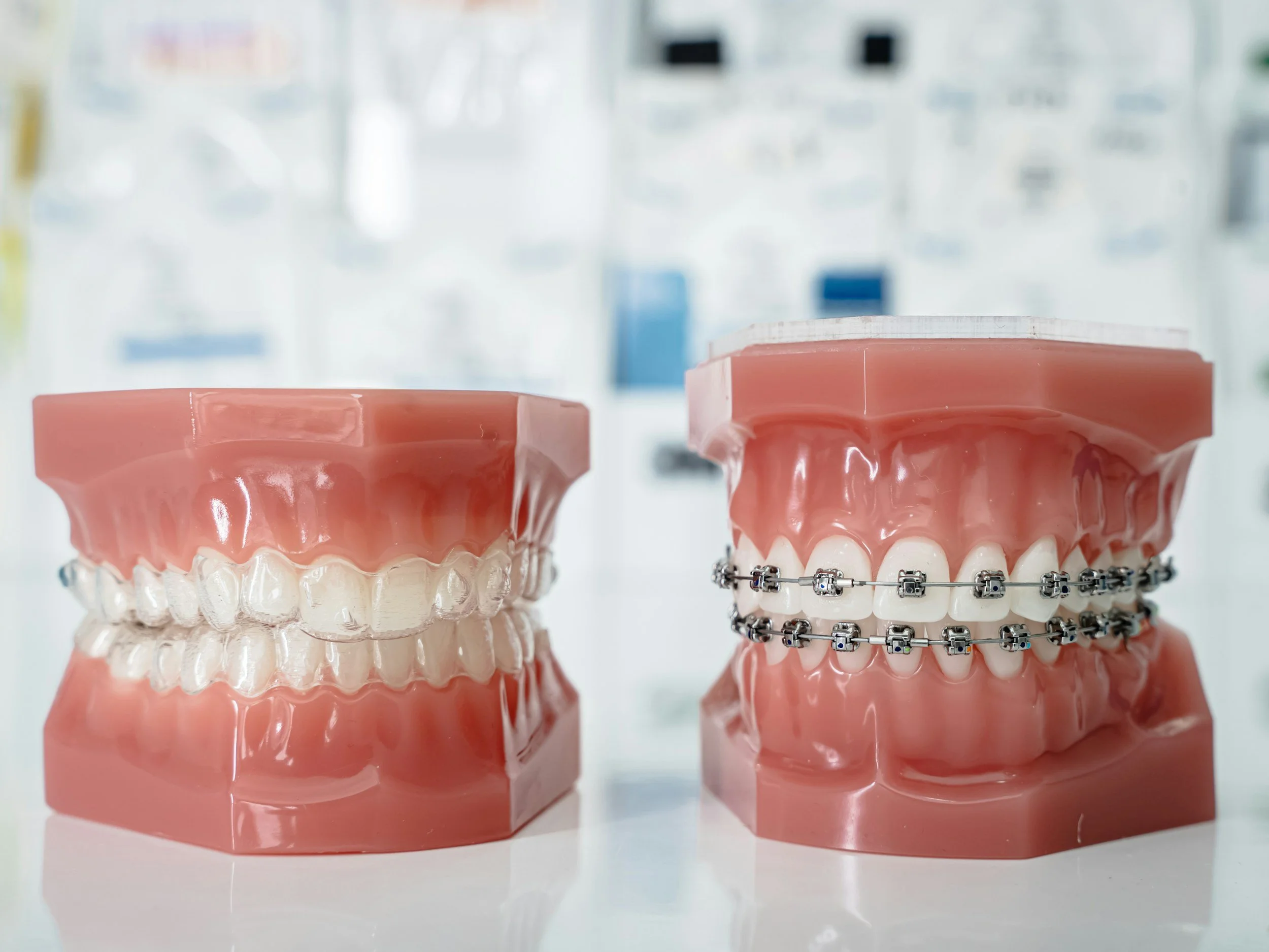 Aparatele dentare îţi oferă soluţia invizibilă pentru un zâmbet vizibil