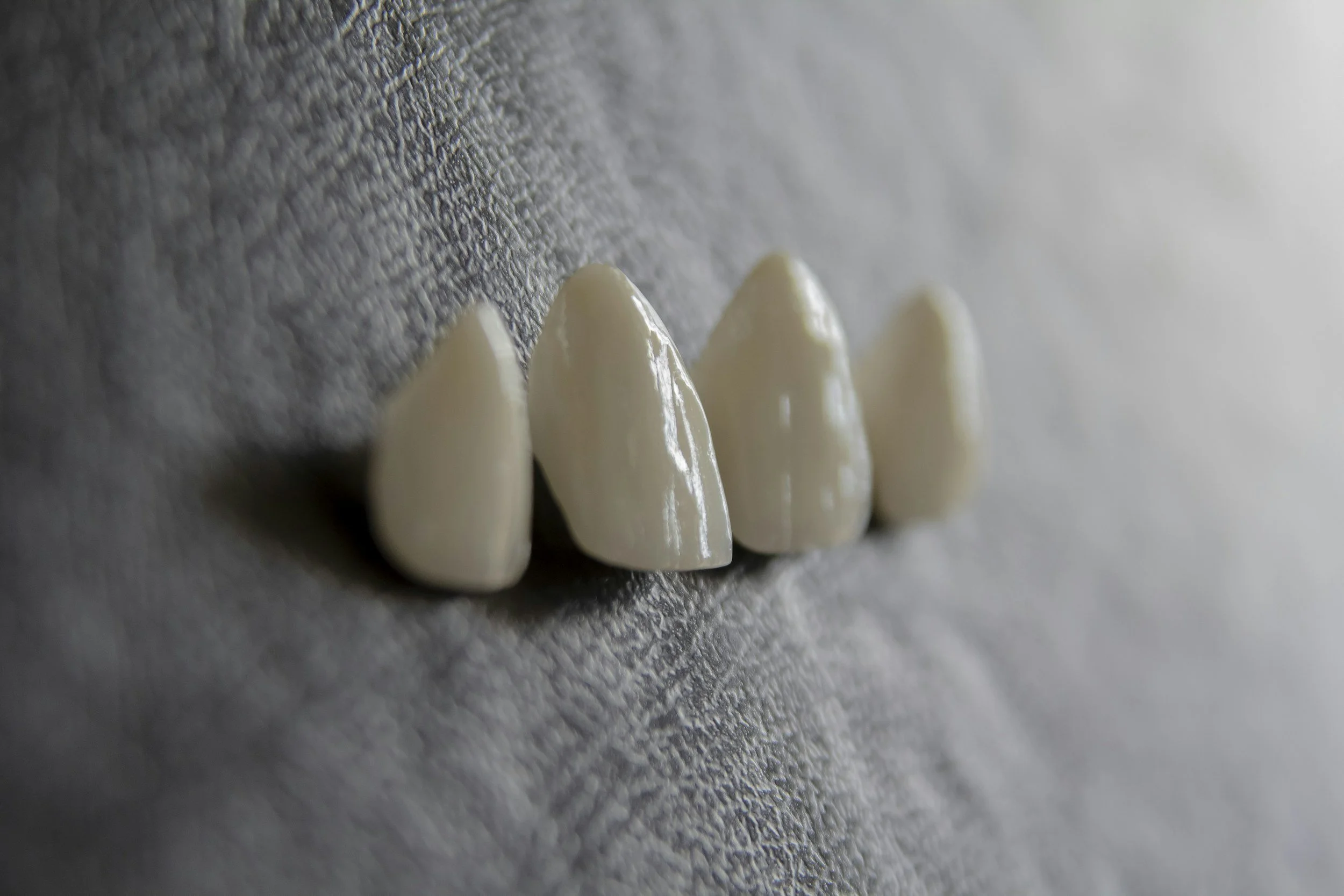 Ce reprezină coroanele dentare?
