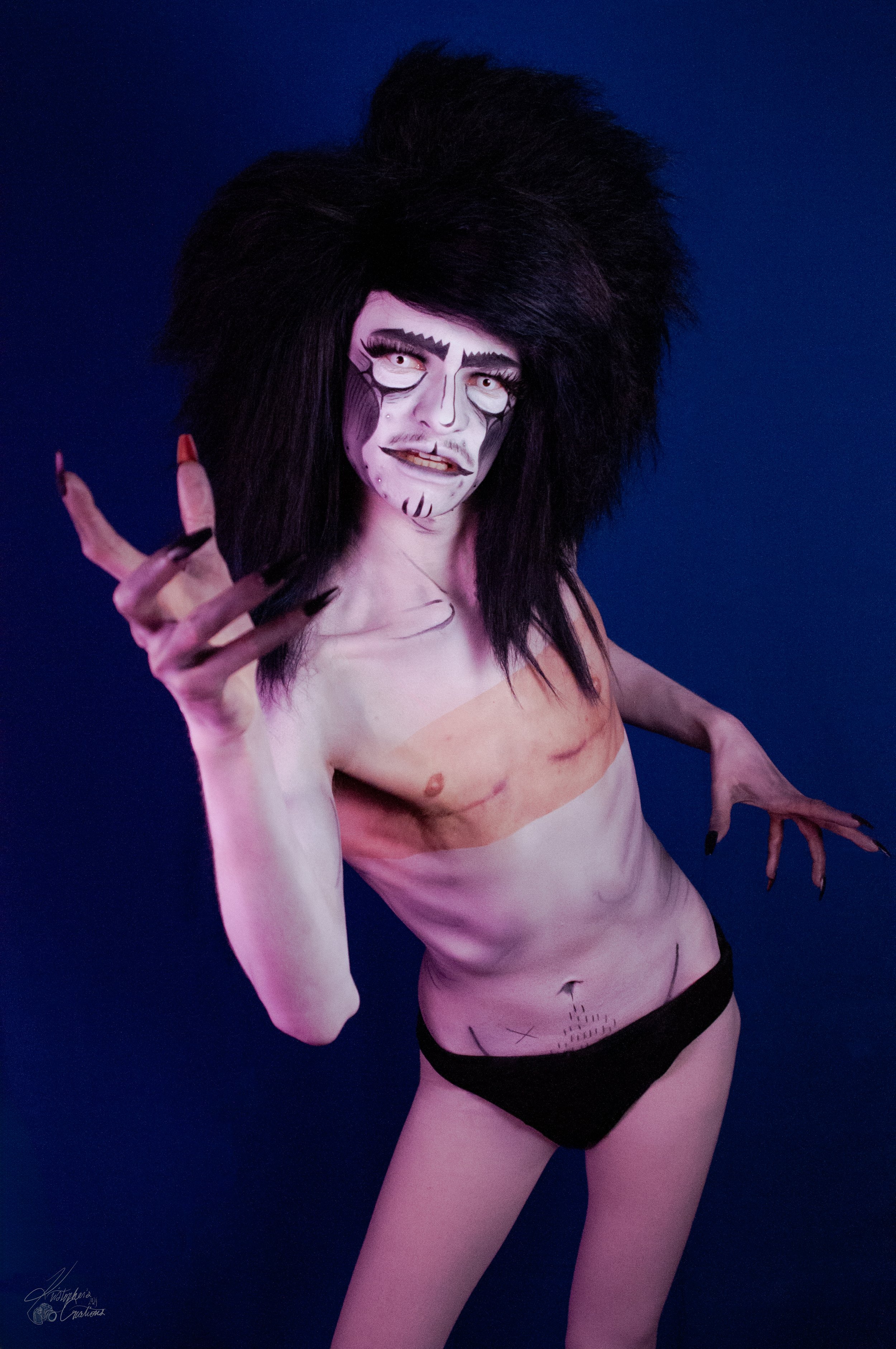 SheanKingTop Surgery  -08.jpg