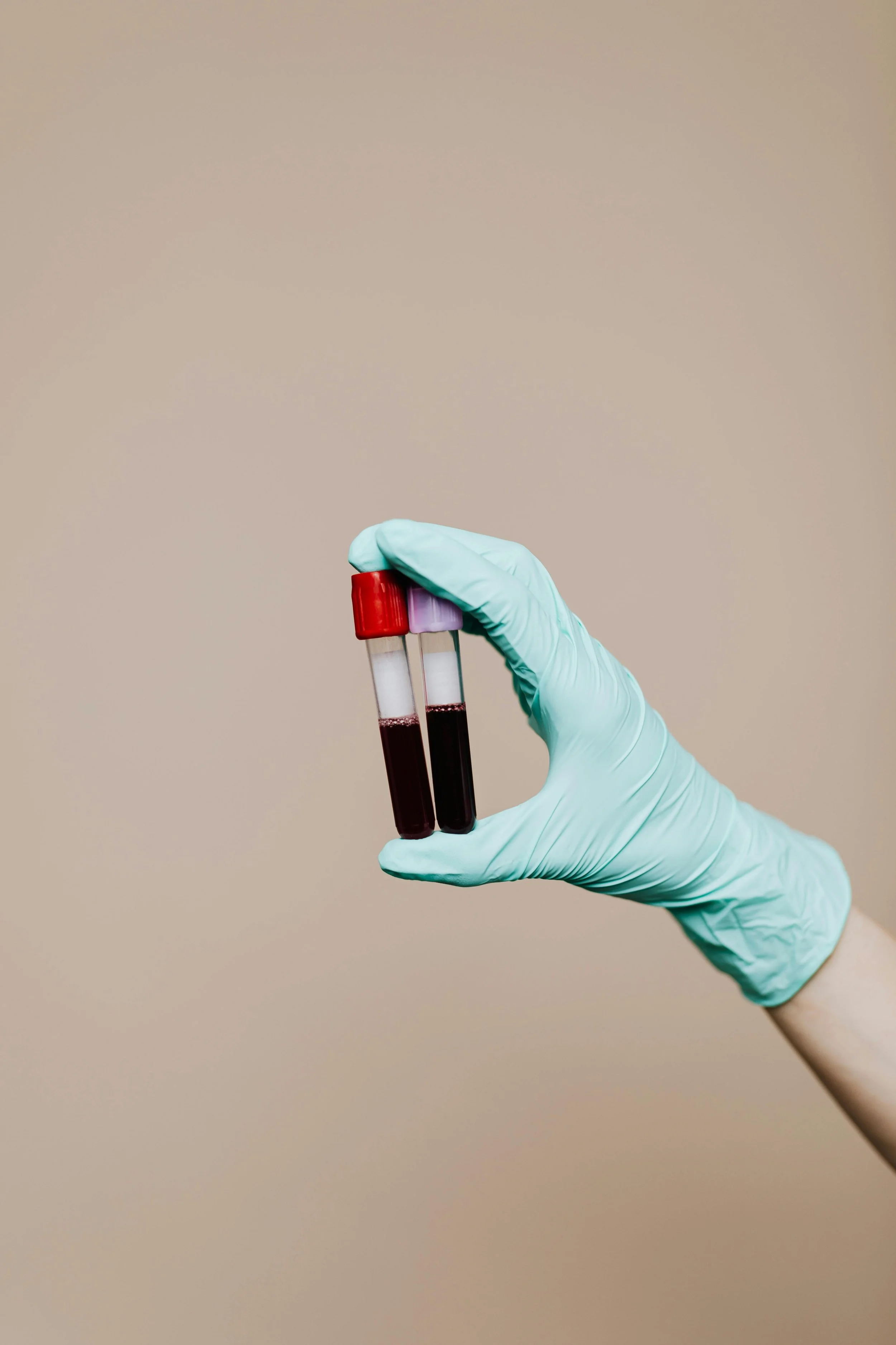 How to Actually Read Your Blood Work — And Why "Normal" Isn't Always Optimal