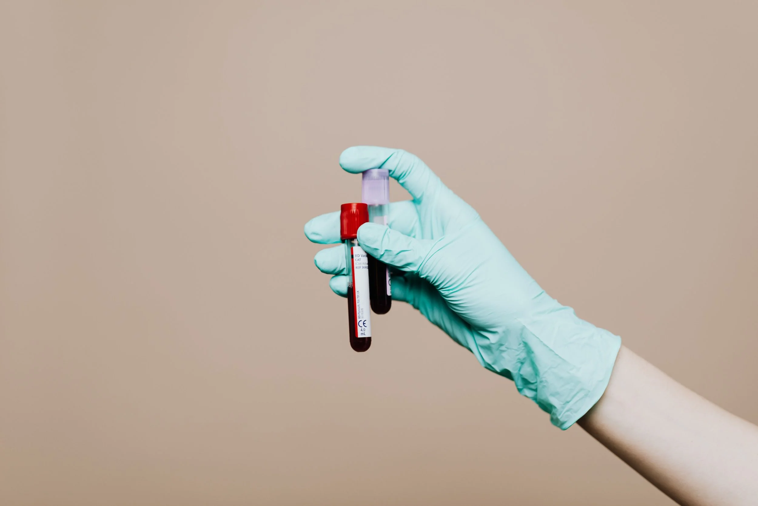 The 10 Lab Tests Every Woman Should Ask For — And What They Actually Mean