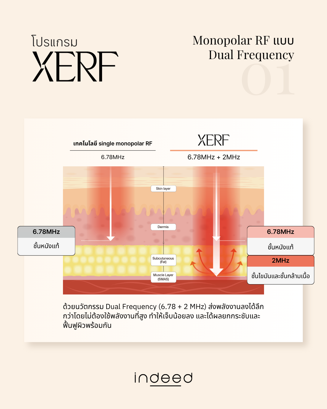 2026 Xerf Early Access (2).png