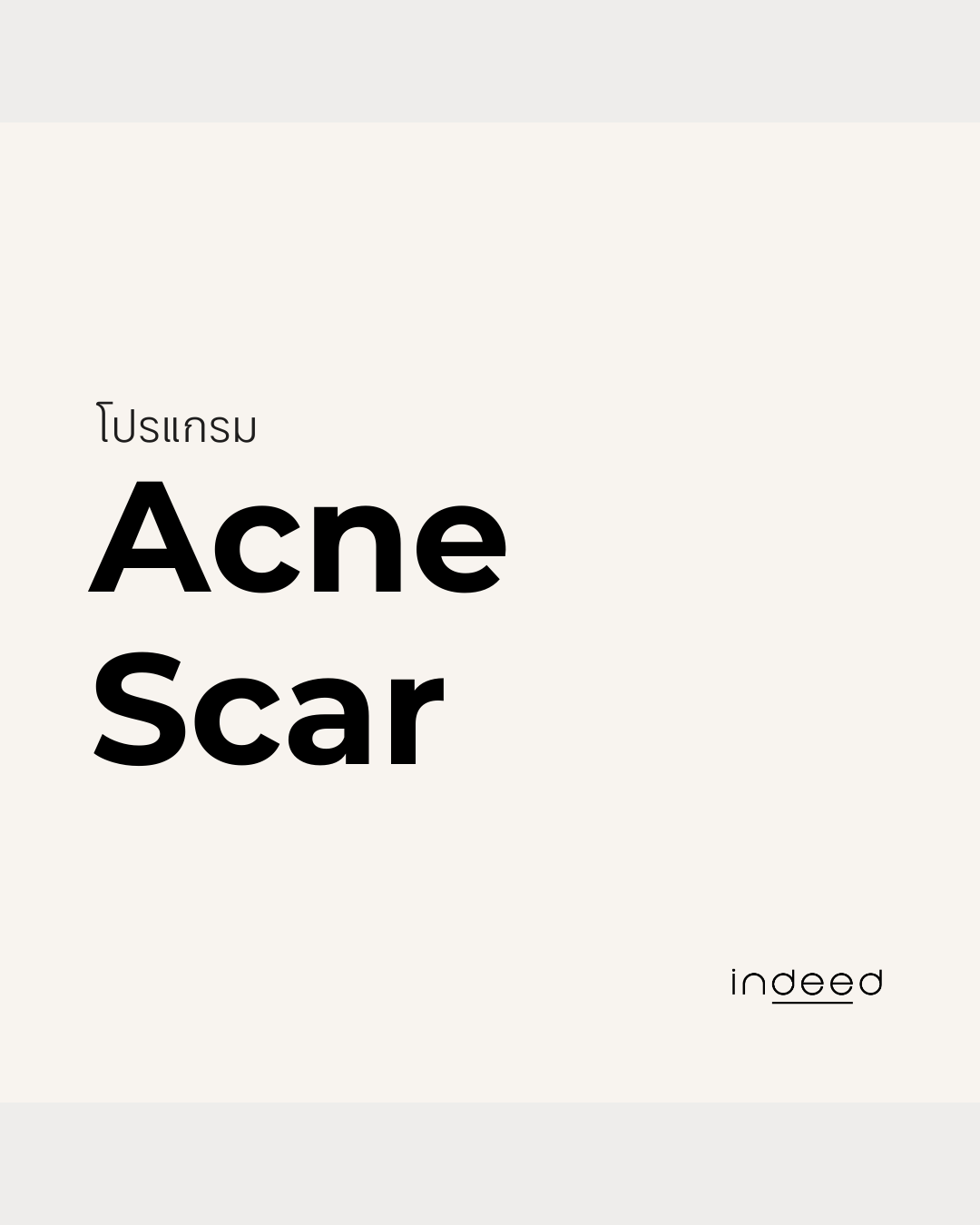 หลุมสิว · Acne Scar
