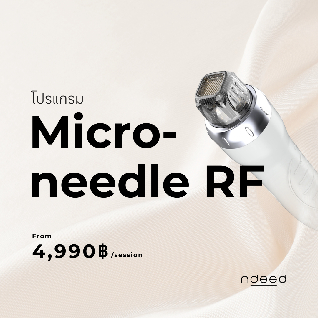 Microneedle RF