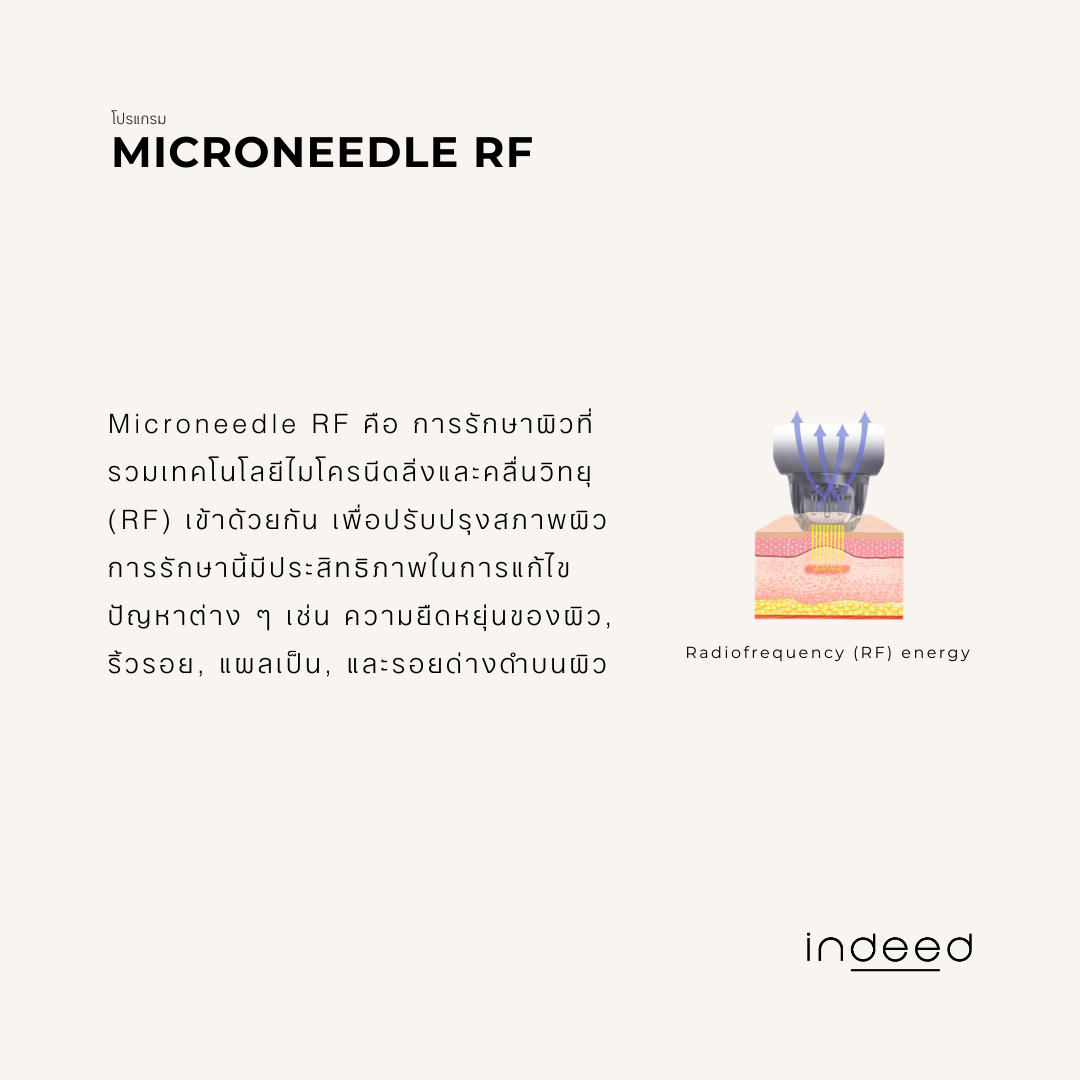 5Microneedle RF2.png