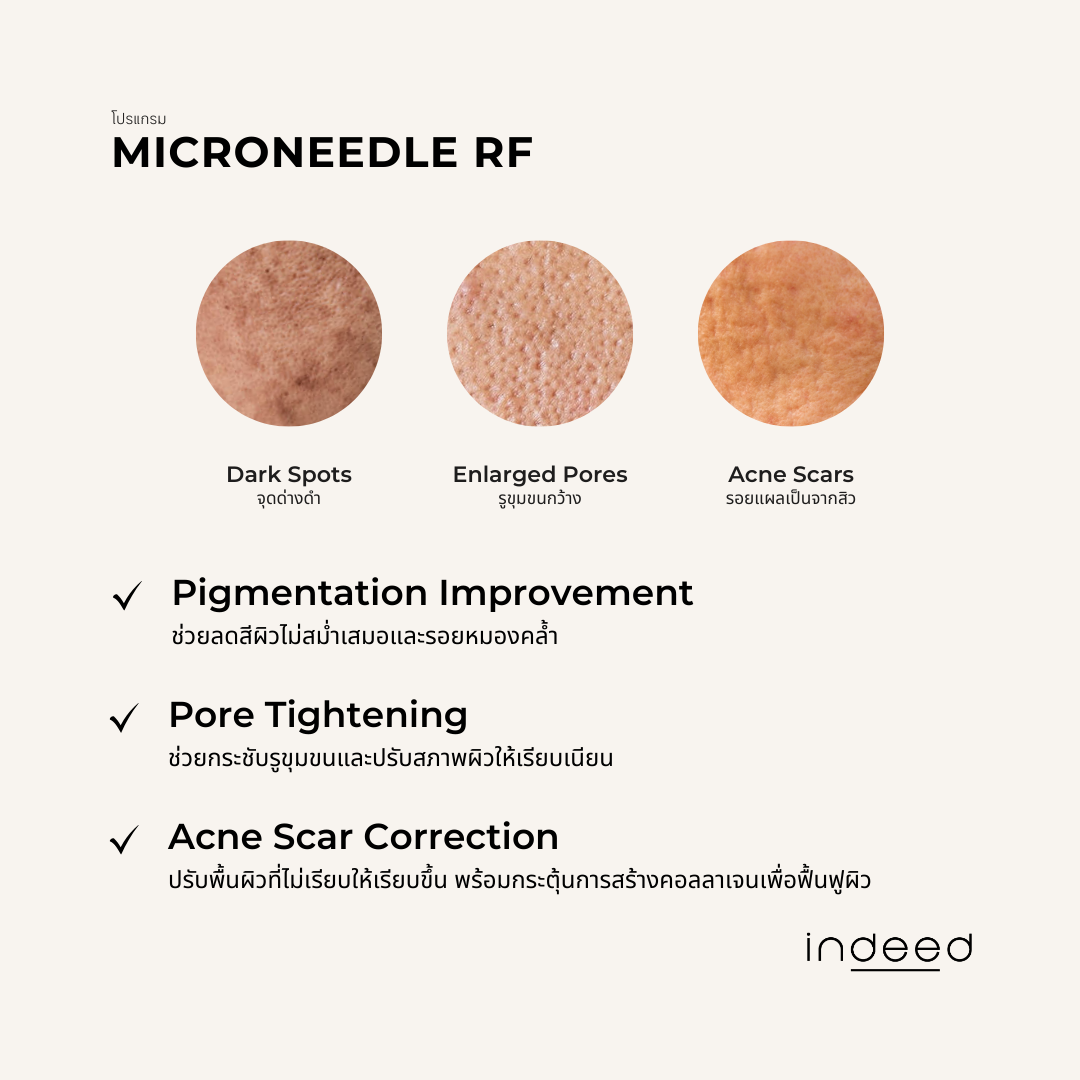 5Microneedle RF3.png