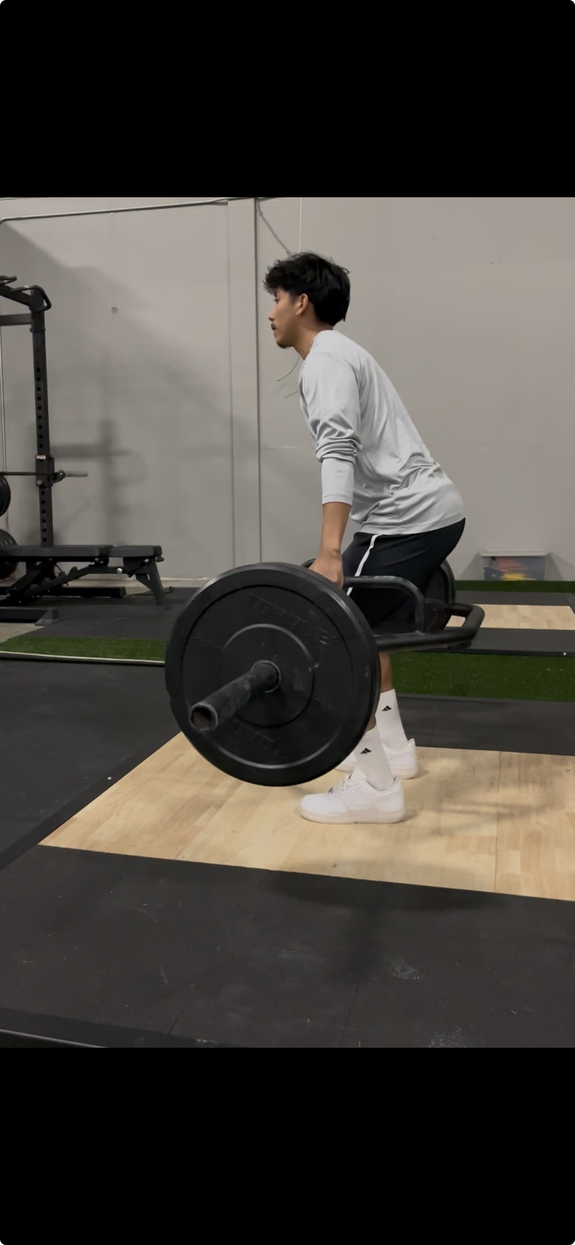 LCL Injury Rehab in Soccer: A Pro-Level Case Study on Return to Sport