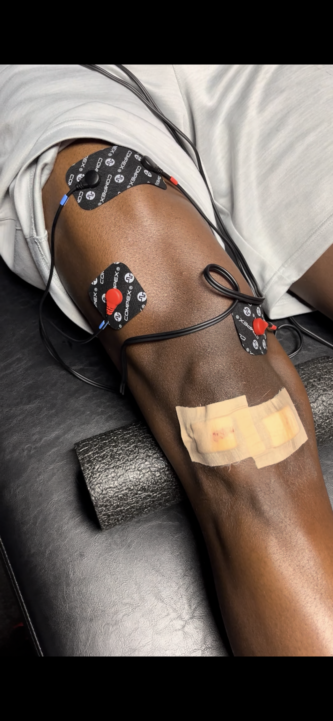 Electrical Stimulation for post op ACL patient in Eagan MN
