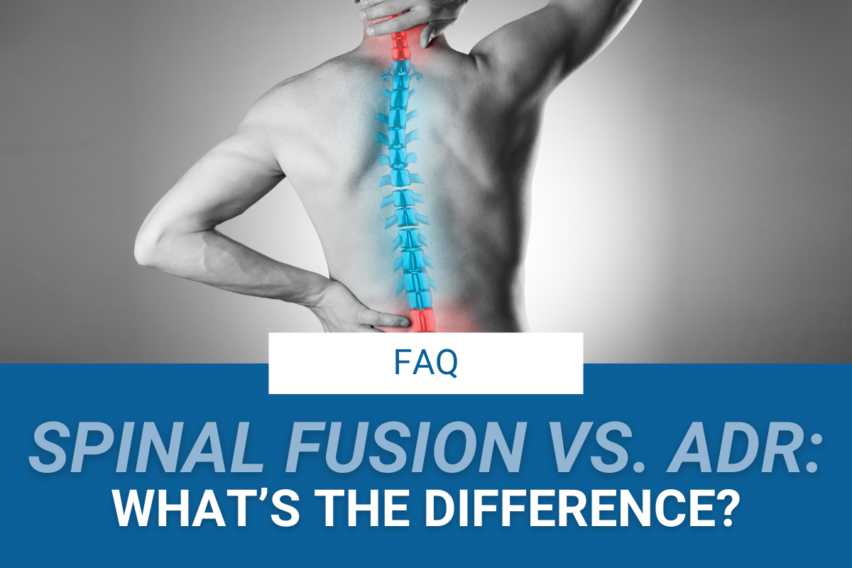 What’s the Difference Between Disc Replacement and Spinal Fusion?