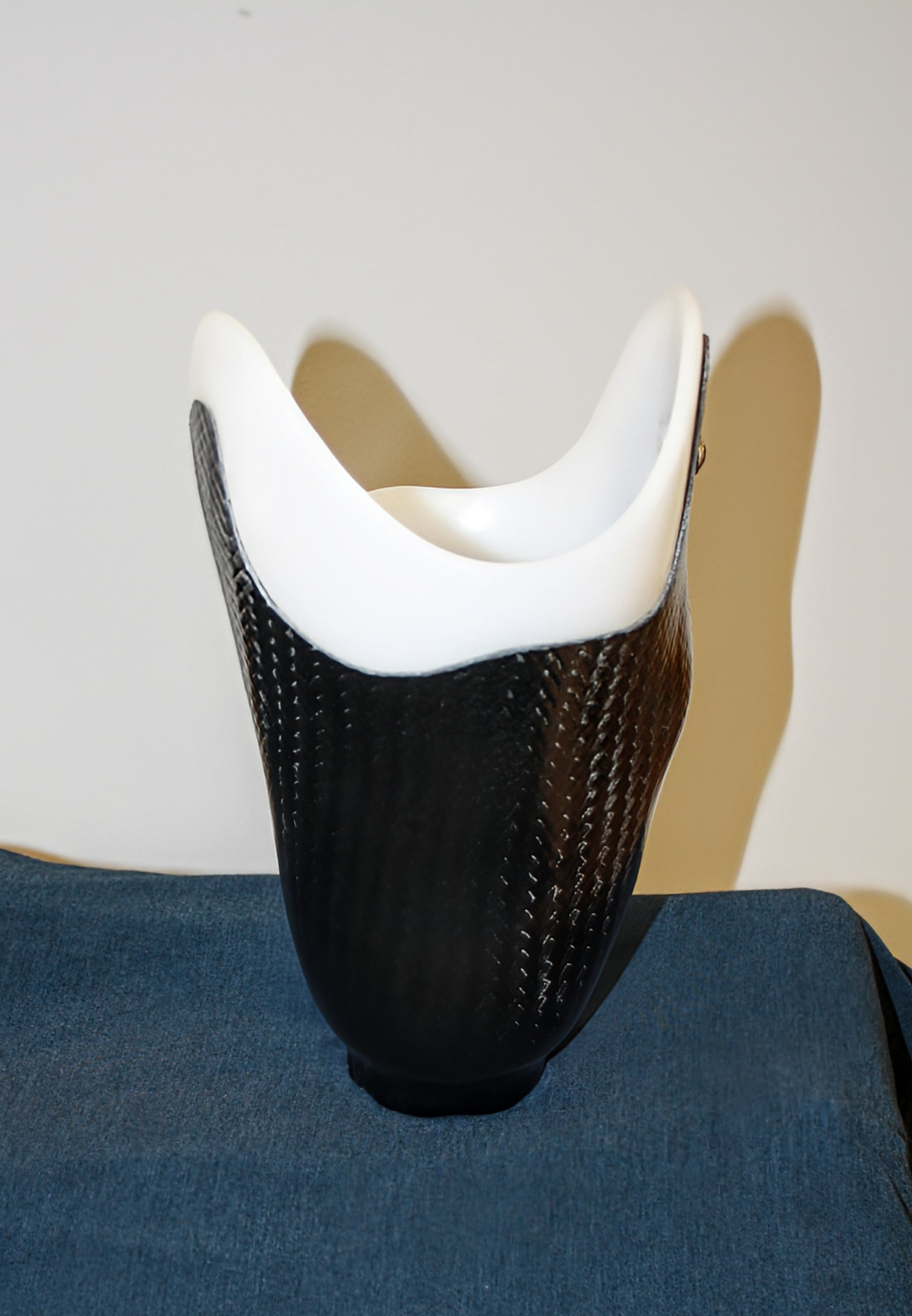 Below the knee, TTA, transtibial, BK socket with carbon fiber frame
