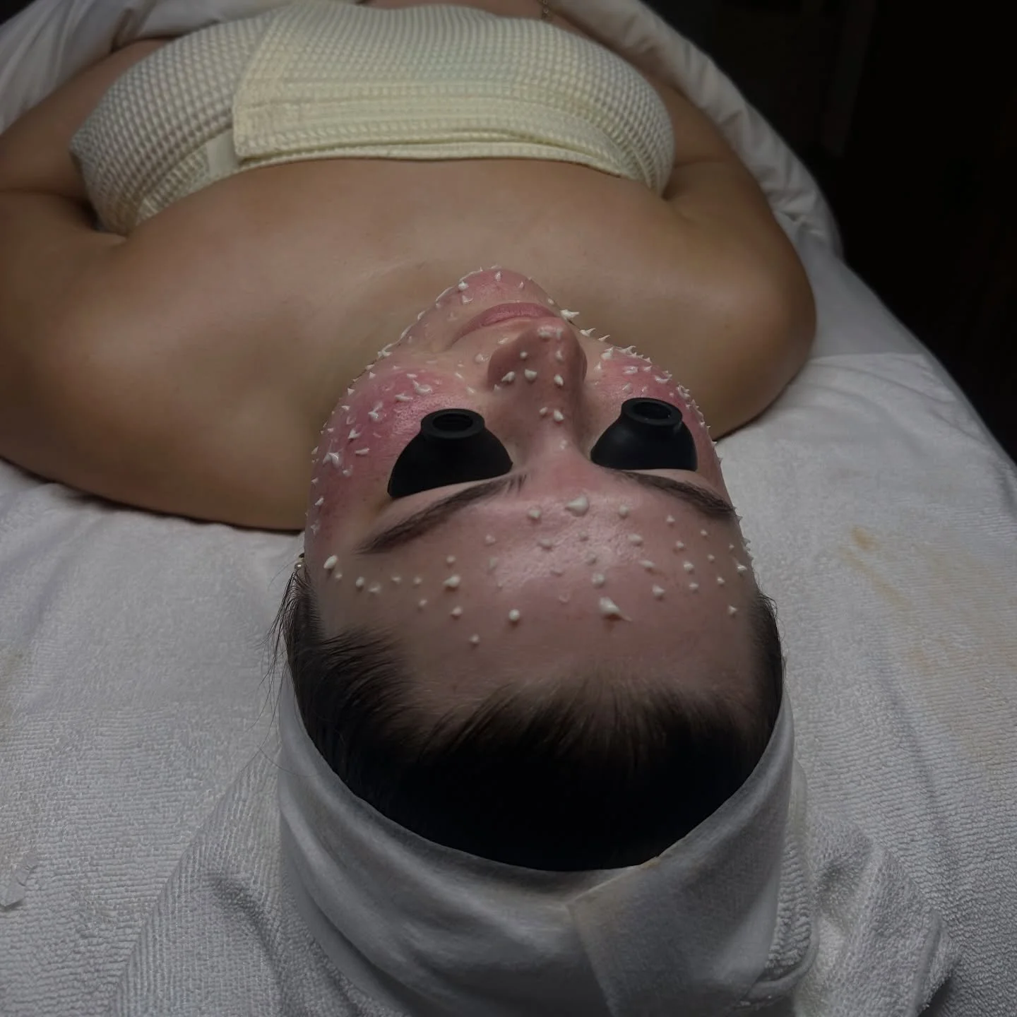 What are those little white dots? 

This is liquid microneedling using microscopic sponge spicules from Cellstory.

Over 50,000 microscopic spicules are massaged into the skin creating natural microstimulation that triggers intense cellular turnover,