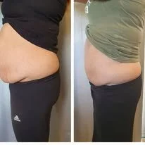 Side-by-side comparison of a person's midsection before and after weight loss, showing a slimmer profile in the after photo.