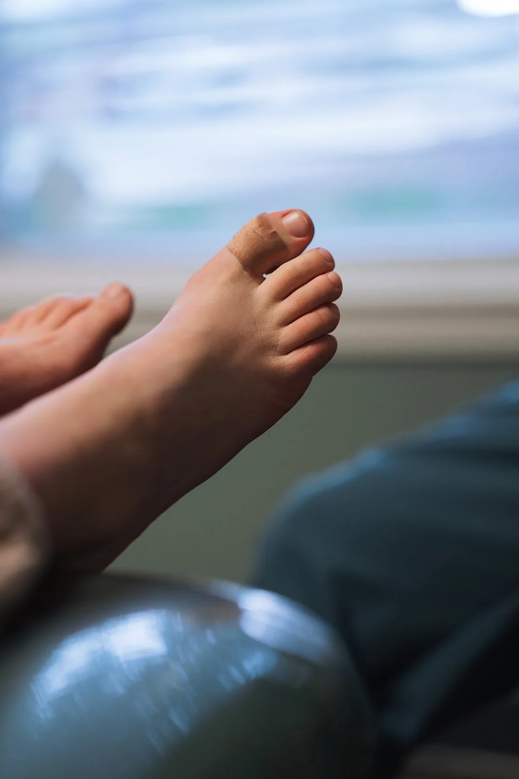 Bunions (hallux valgus)