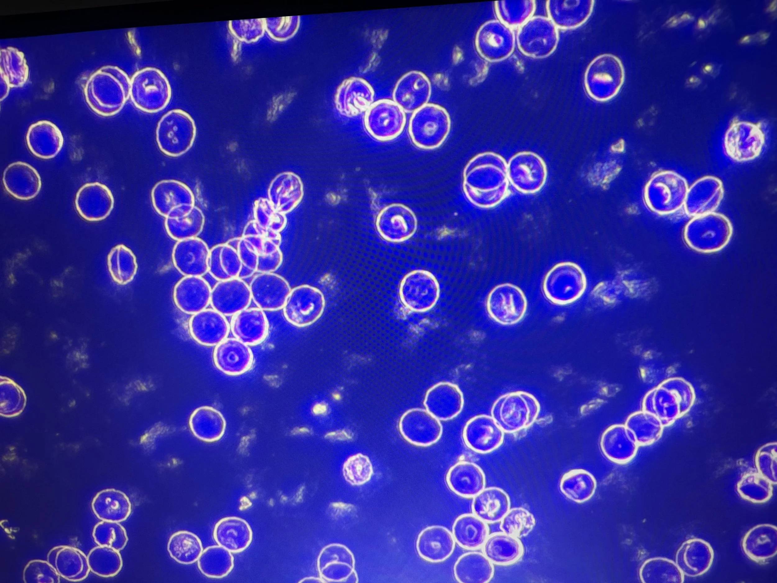 Microscopic view of numerous small, circular cells with purple and yellow outlines against a dark blue background.