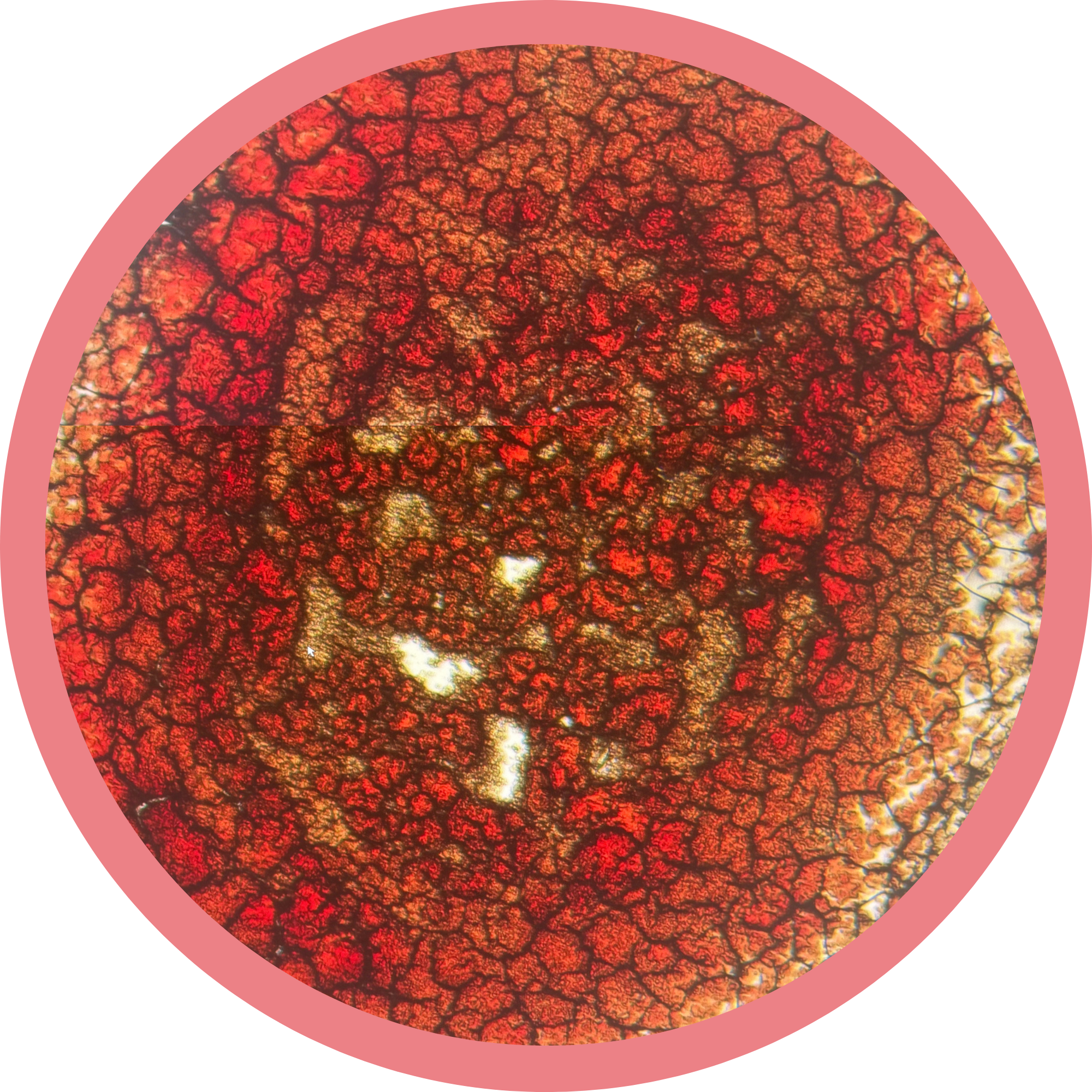 Close-up view of a dry sample of blood, blood under a microscope