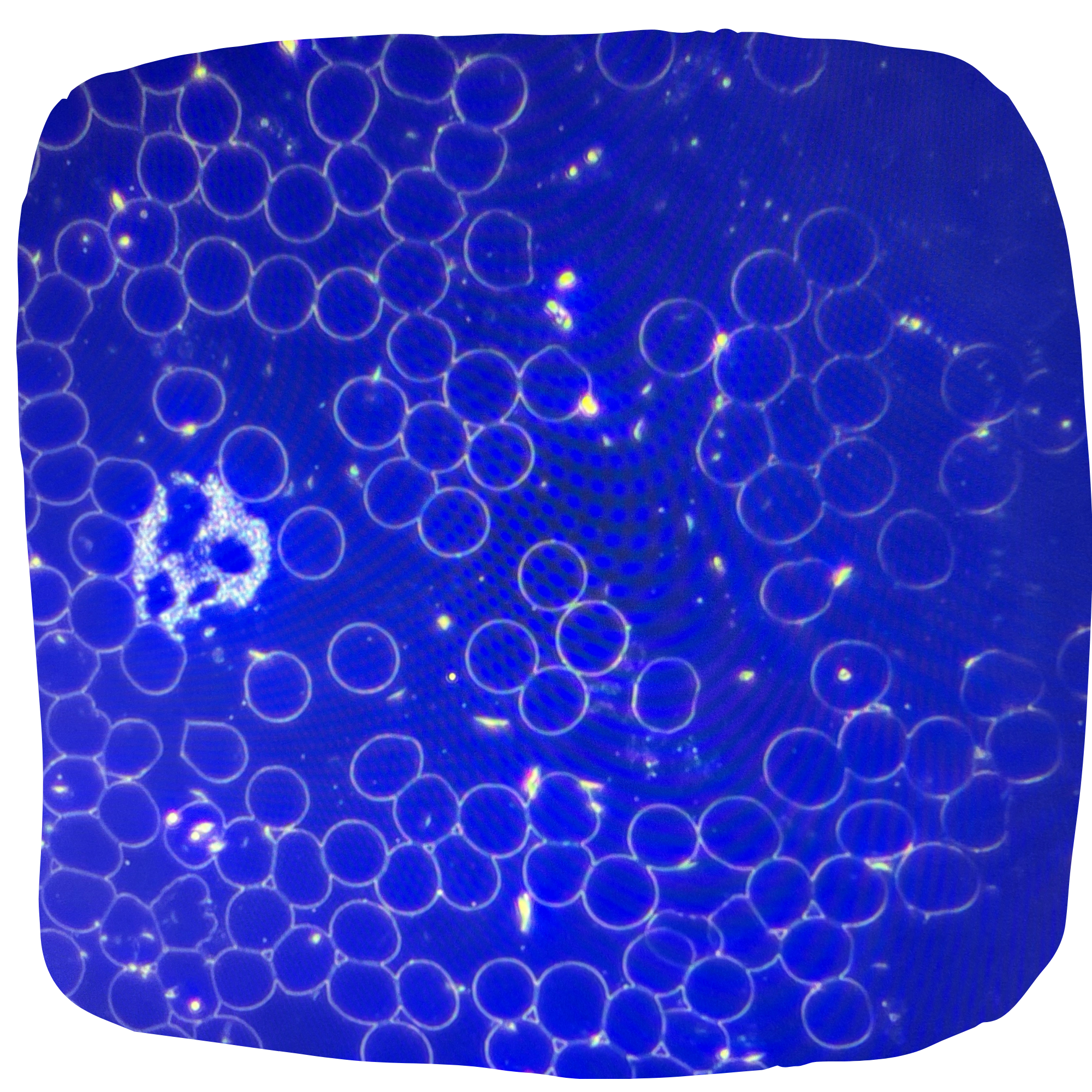 Live Blood Sample, dark field microscope