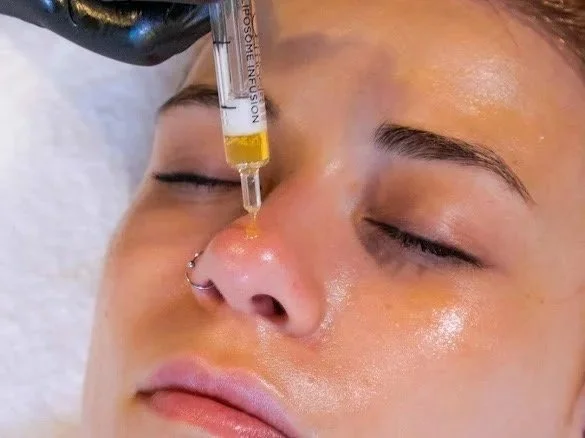Liposome Infusion