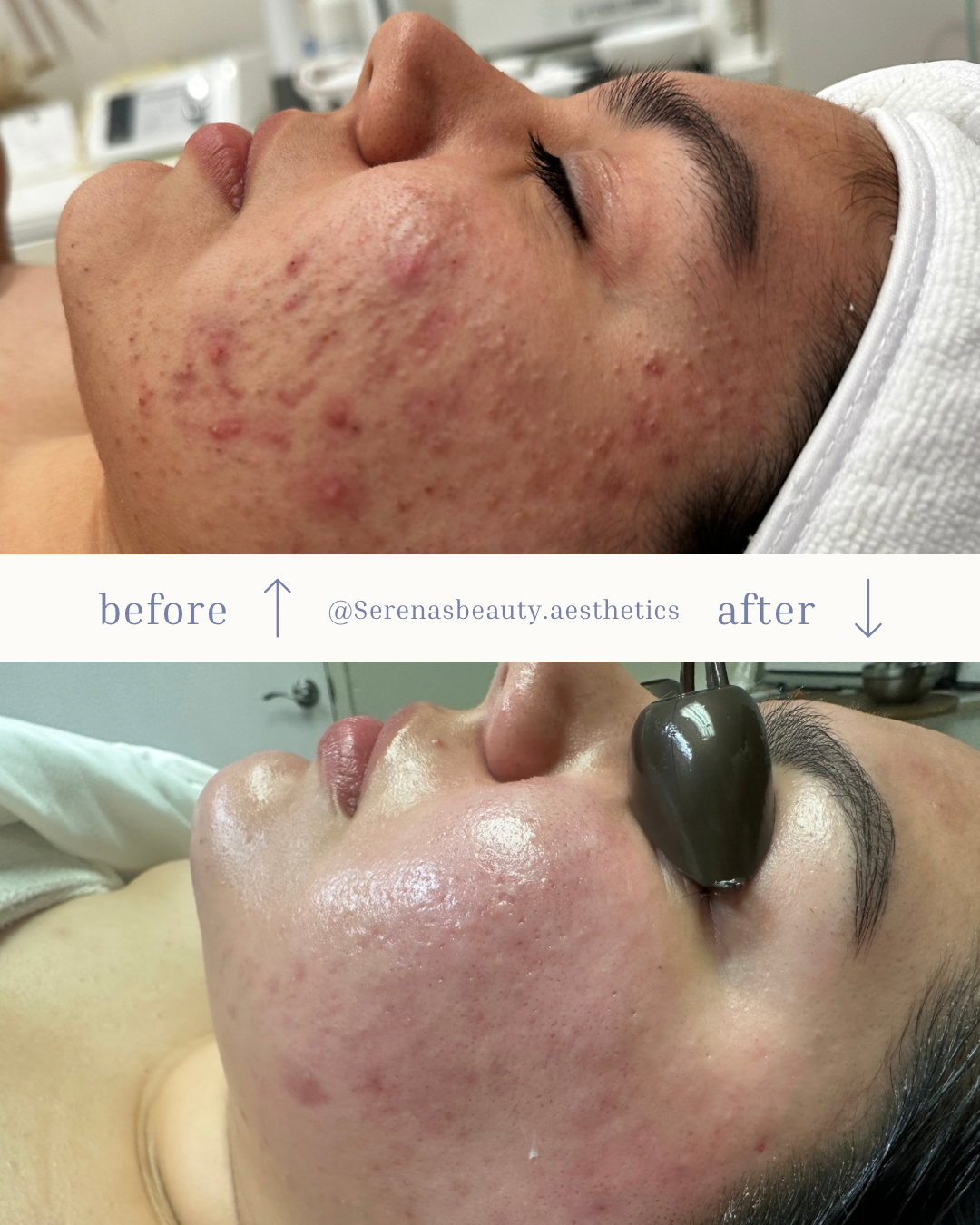 New Home Routine & Chemical Peel Series