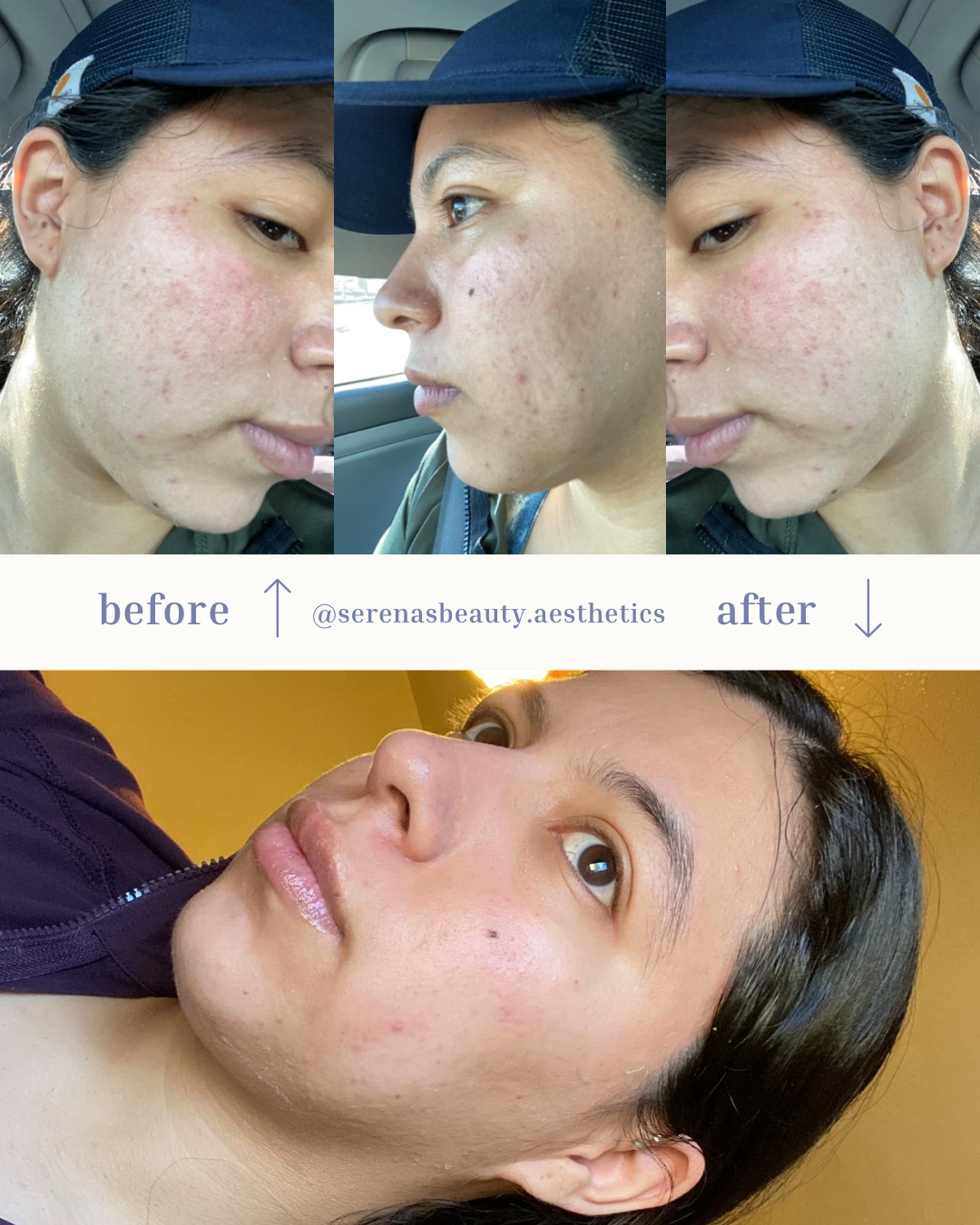 Home Routine & Enzyme Treatments