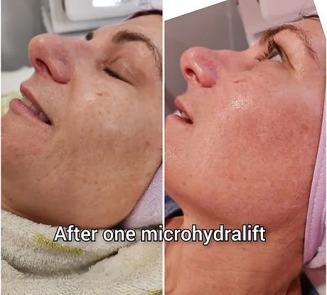 Microhydralift (1).jpg