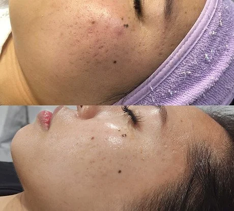 Microhydralift (2).jpg
