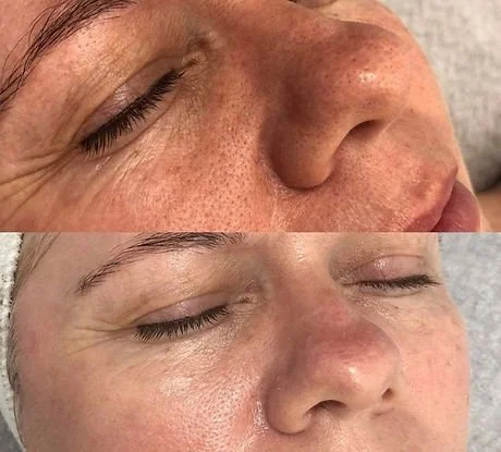Microhydralift (3).jpg