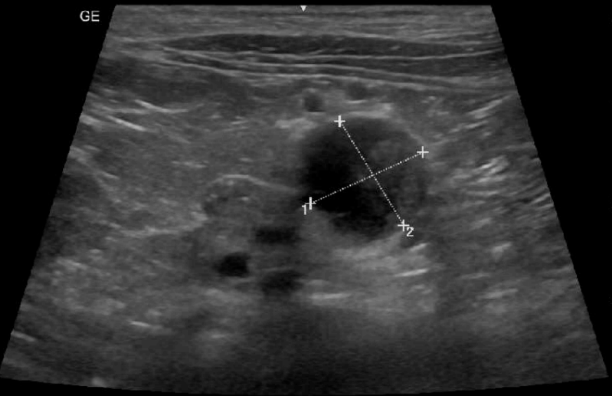 Urgent/ On Call Abdominal Ultrasound and Echocardiogram