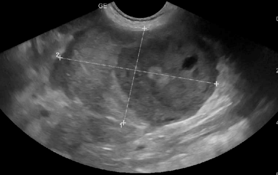 Ultrasound Protocols and Scheduling