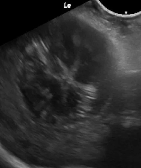 Urgent/ On Call Abdominal Ultrasound and Echocardiogram