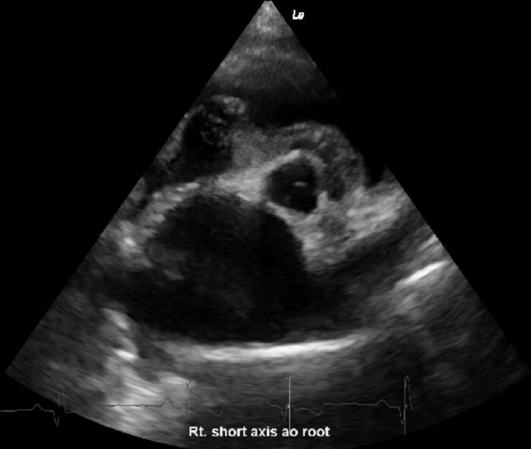 Ultrasound Protocols and Scheduling