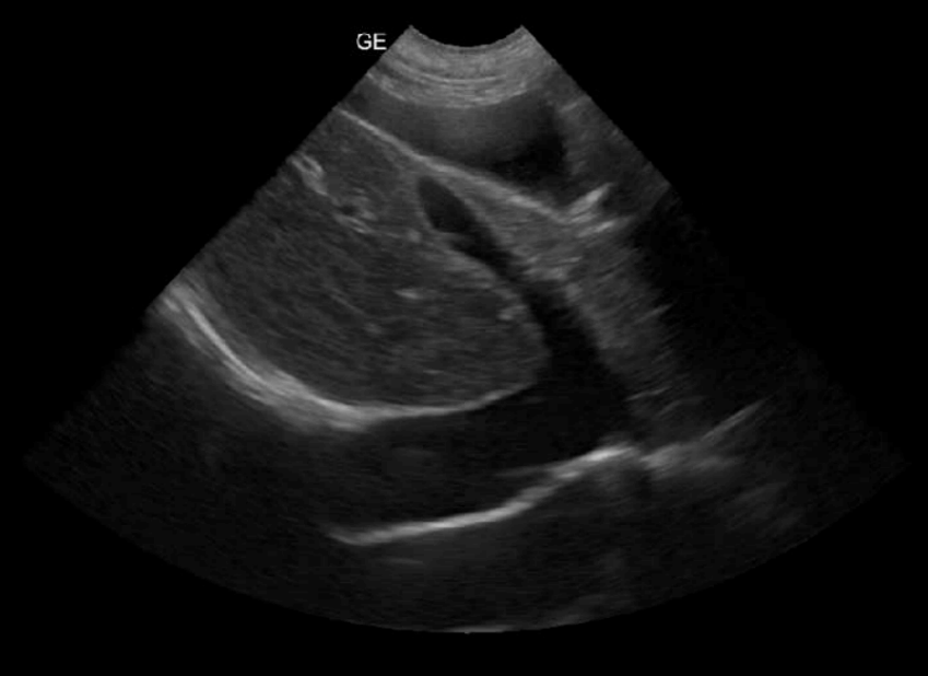 Thoracocentesis, Abdominocentesis, Pericardiocentesis