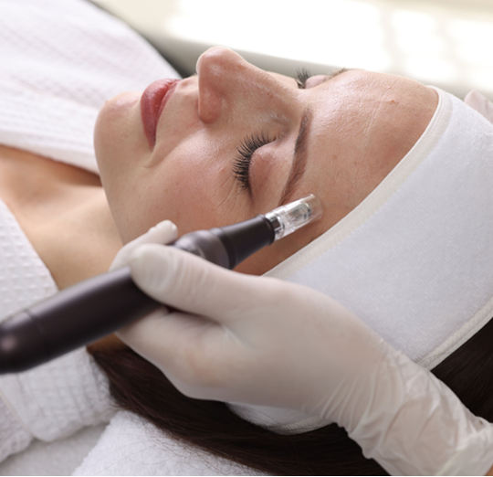 KORÉ Aesthetics Microneedling