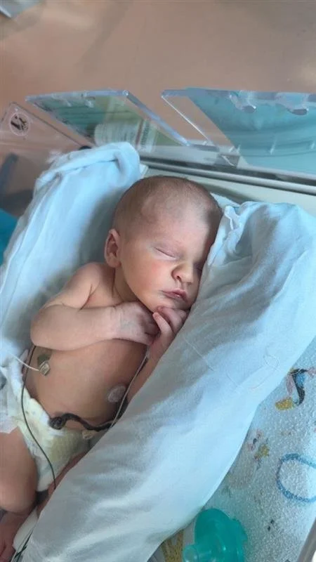 A newborn baby sleeping in a hospital bassinet with medical tubing attached.