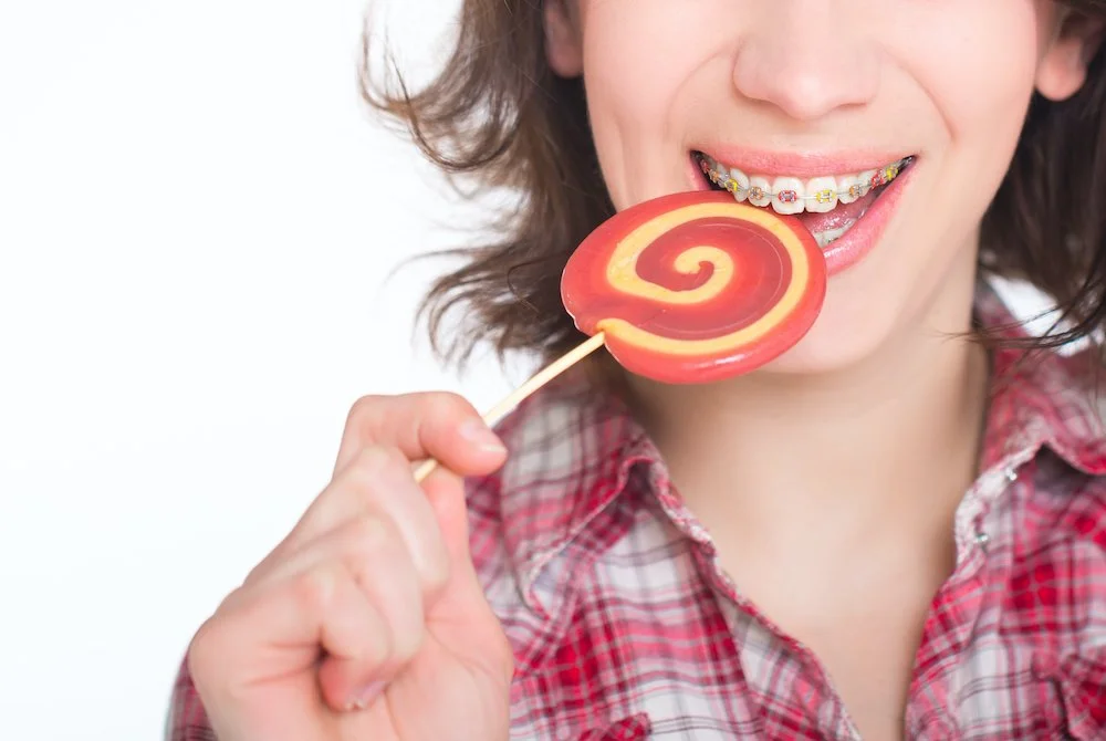 Essential Tips for Maintaining Clean Braces