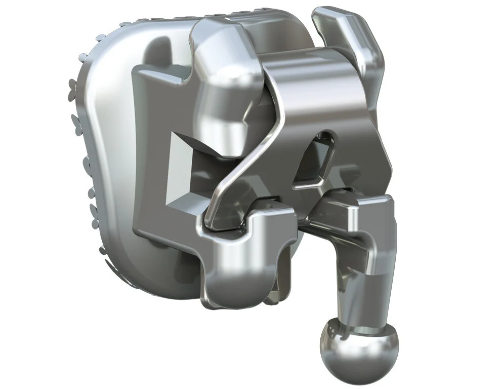 Self-ligating braces faster treatment and reduced discomfort