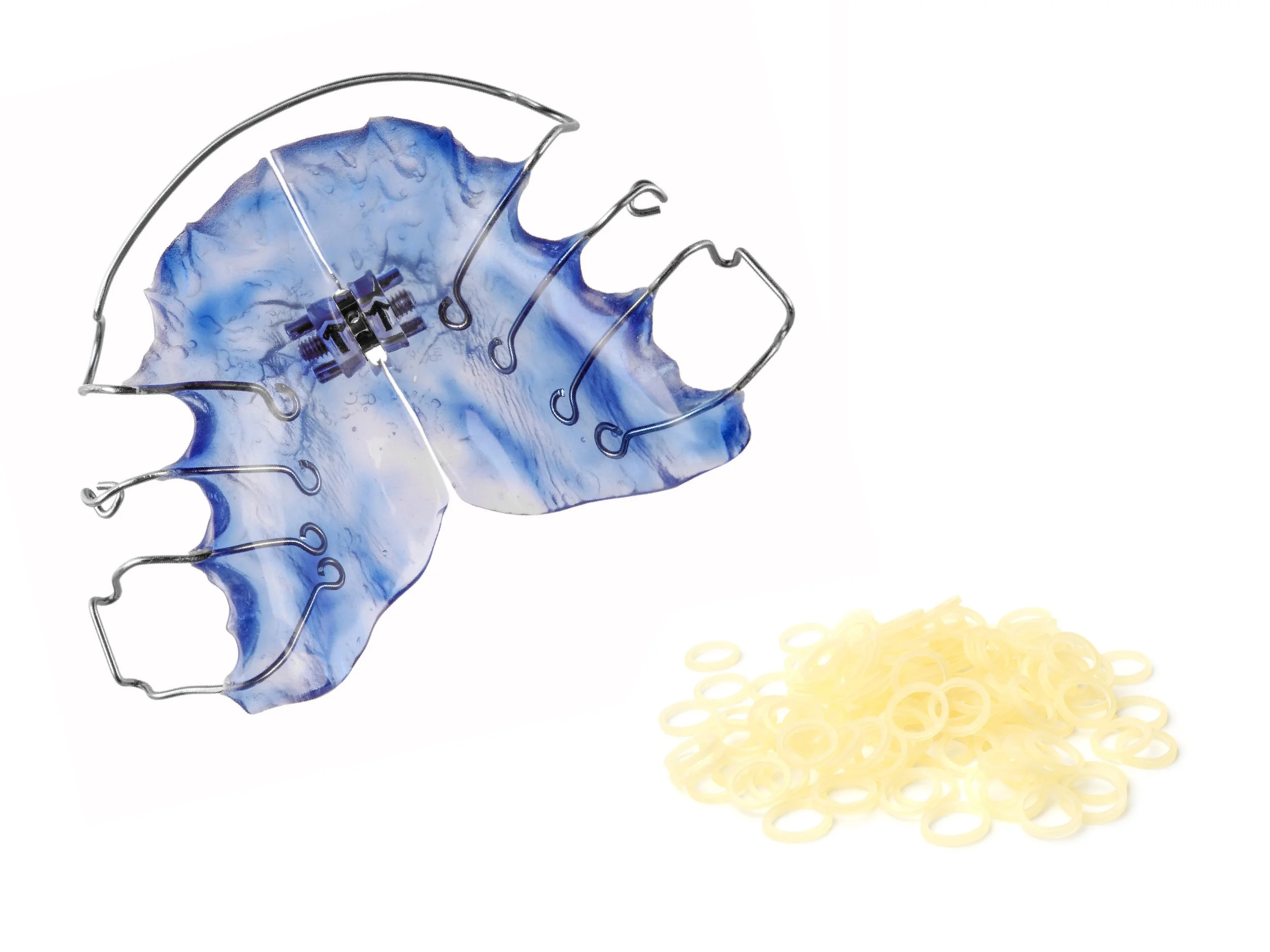 Intra-oral Appliances - Expander and Elastics