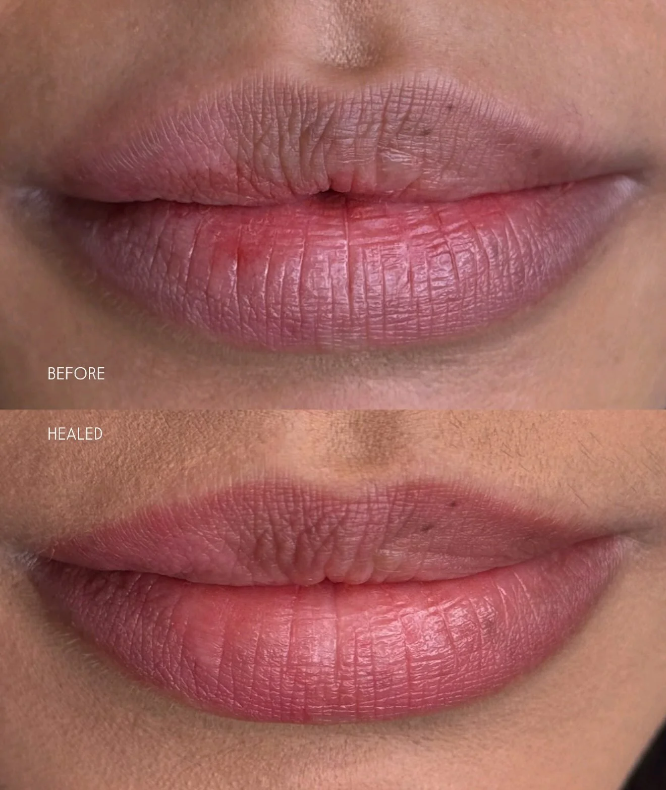 HEALED DARK LIP NEUTRALISATION

Here&rsquo;s before and healed vs directly after the tattoo. I&rsquo;m super pleased with these results after just one session! I love the warmer, pink tones it&rsquo;s added to her lips 👄
#darklips#lipblushtattoo#lip