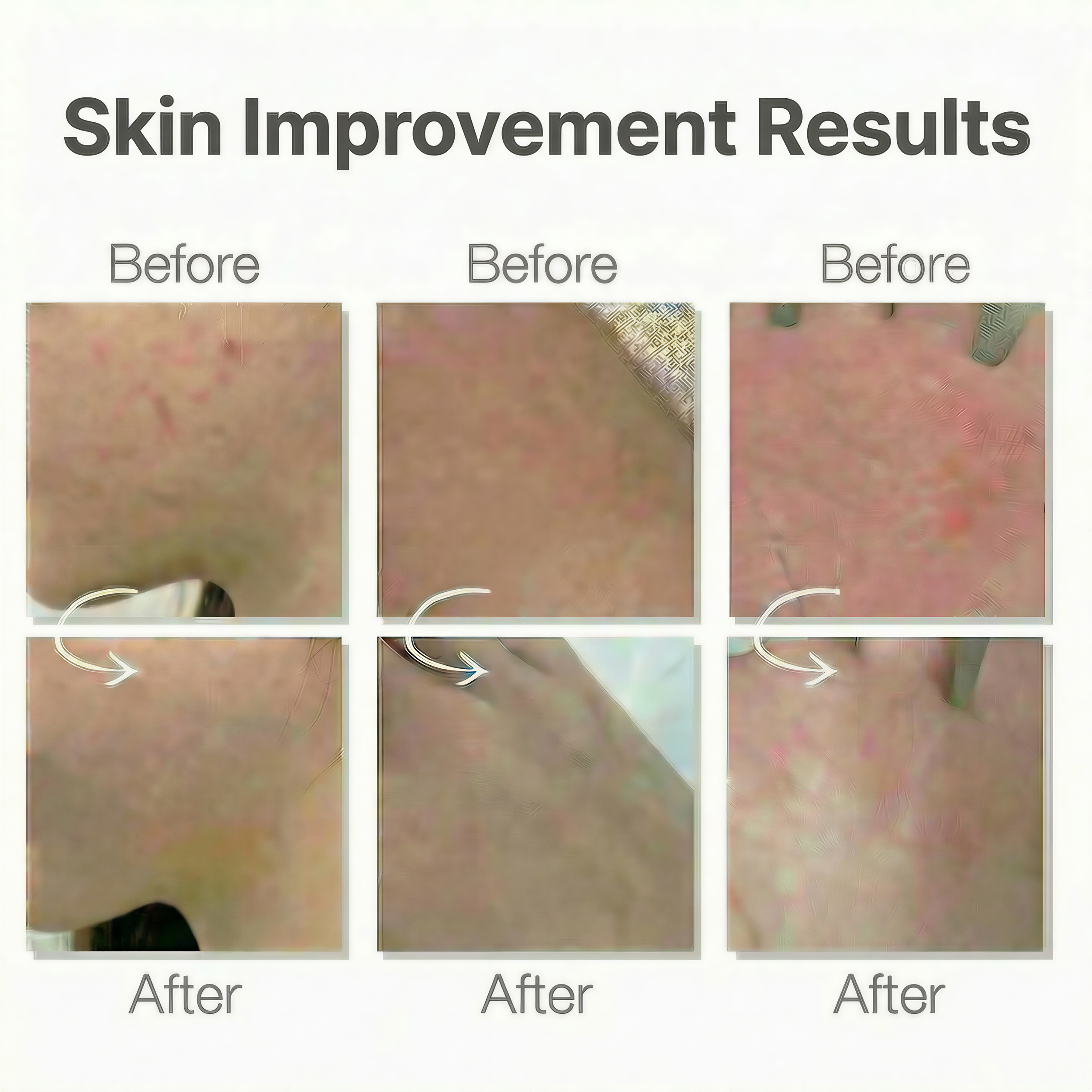 비포 애프터 레이블 작게.png