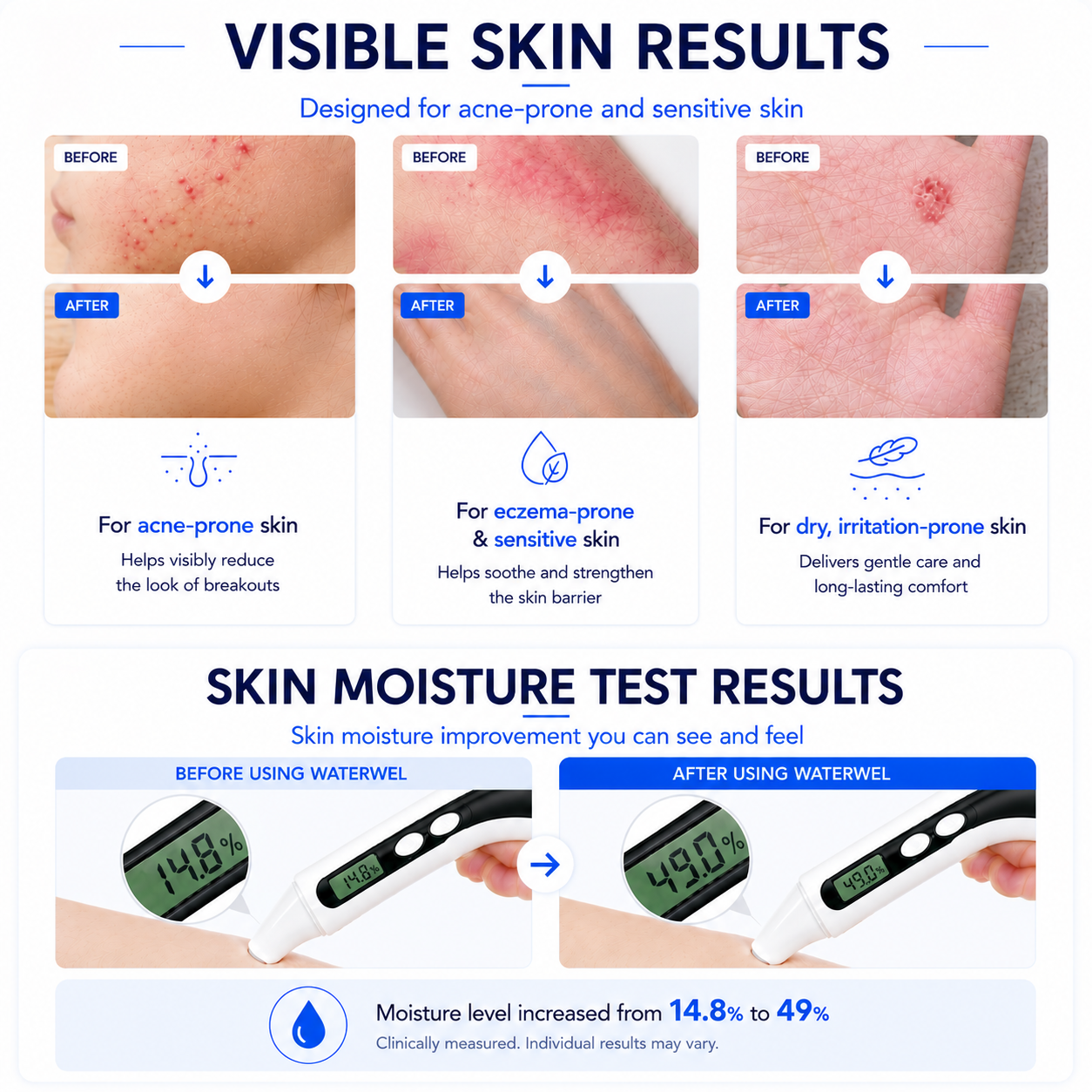 Skin Results.png