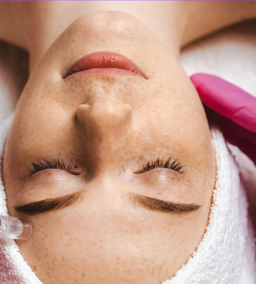 Medspa in Mankato, MN, 56001 Microneedling Near Me.png