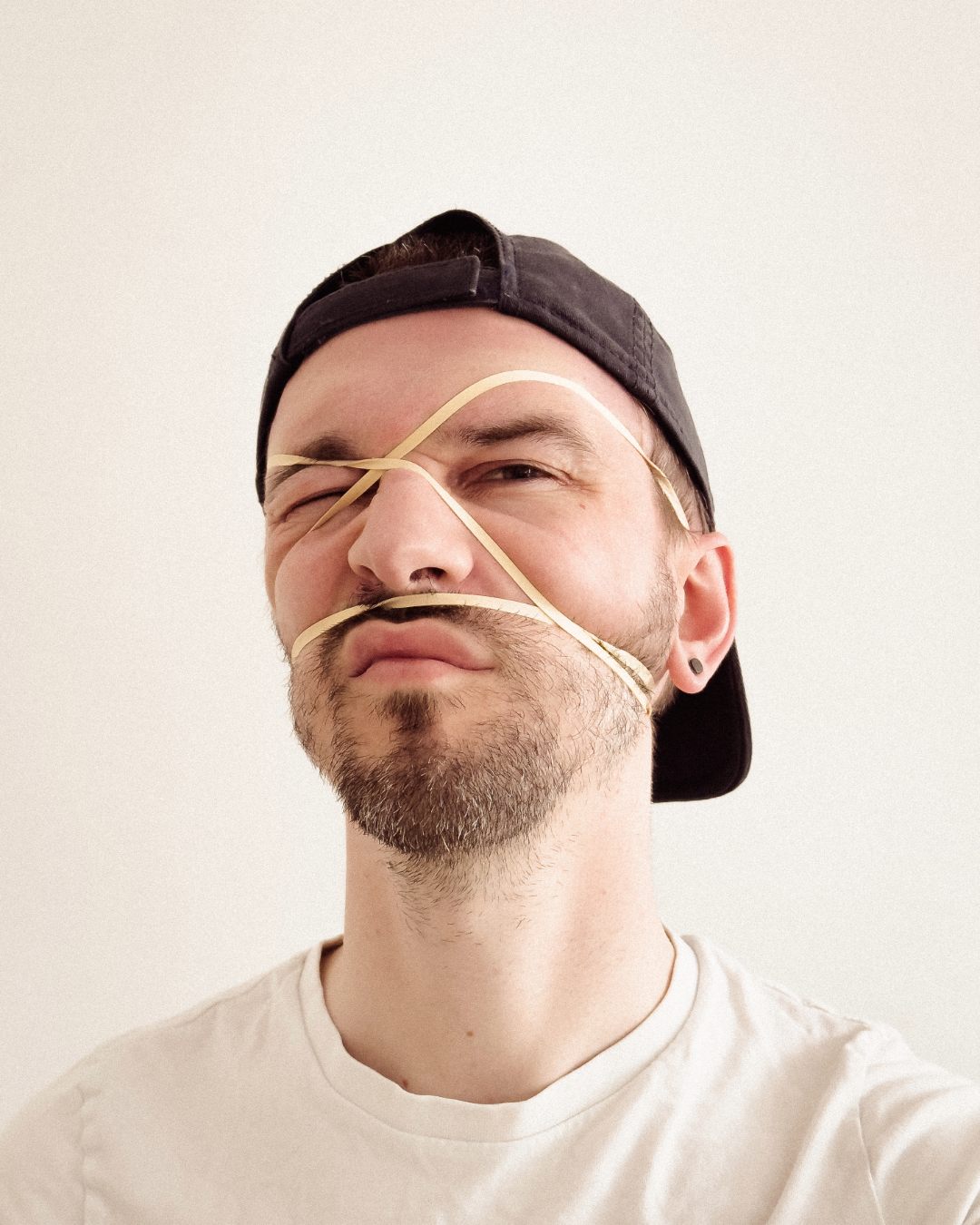 Chris with rubber bands on his face.