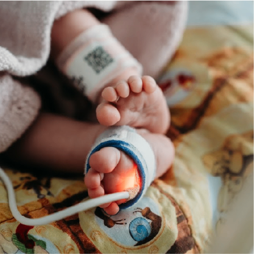 Baby’s foot with hospital ID tag and monitoring equipment in neonatal unit