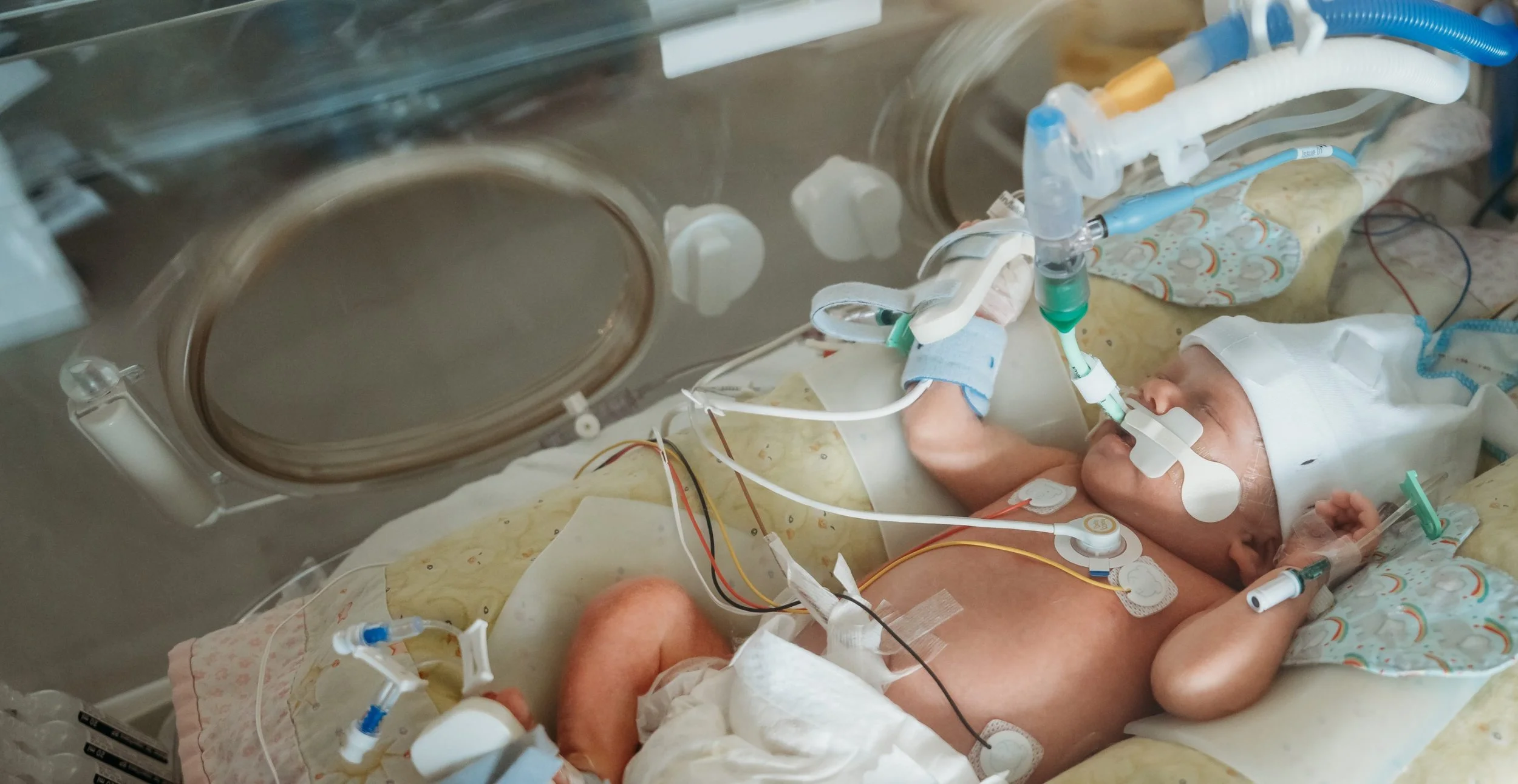 Baby in neonatal intensive care with breathing support and medical wires attached in hospital cot