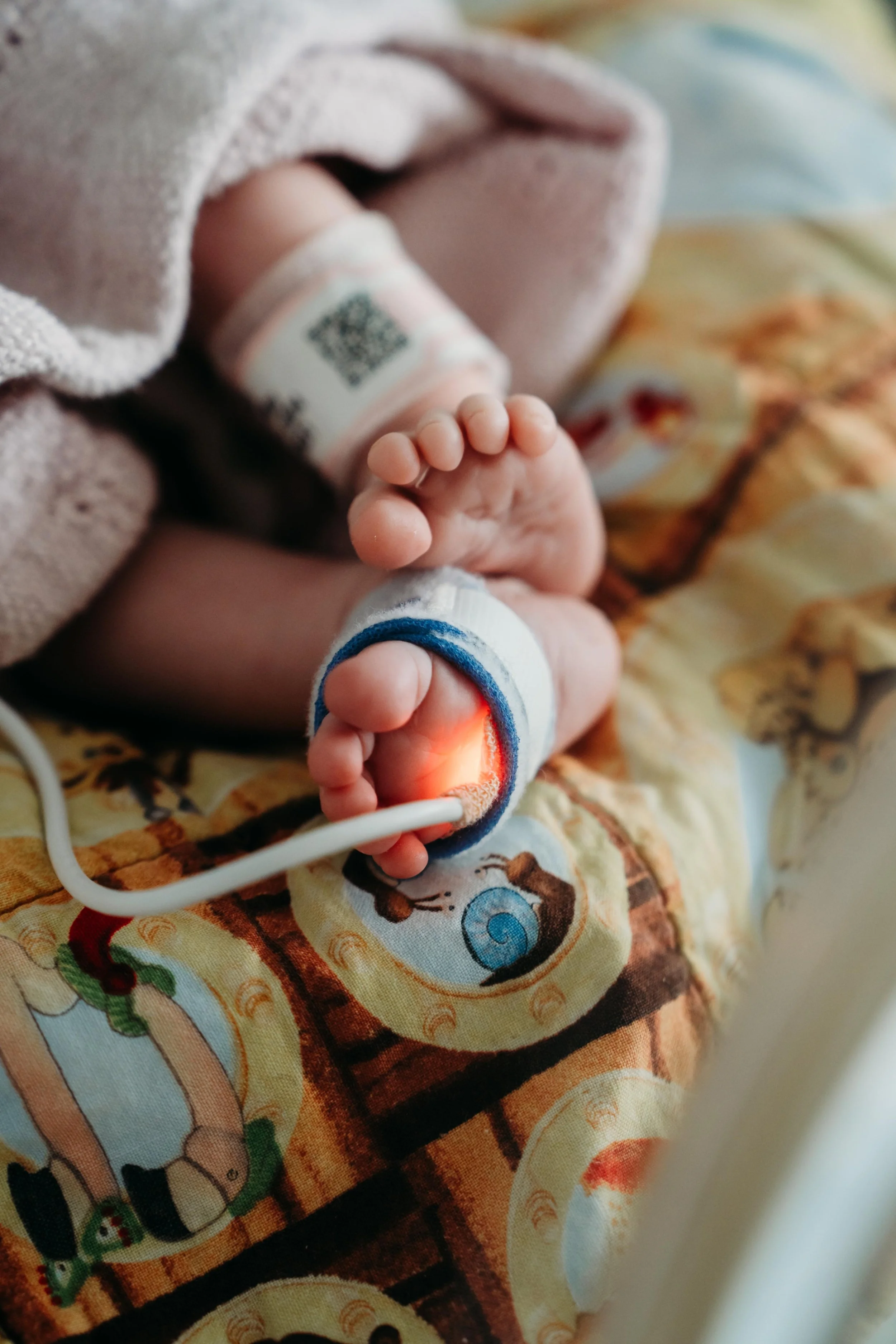 Close-up of baby’s feet with hospital monitoring band and sensor attached