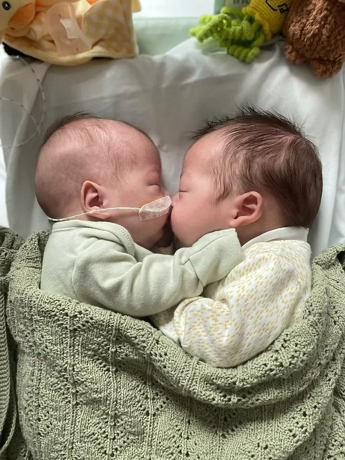 Twin babies sleeping nose to nose one baby with feeding tube both wrapped in blankets